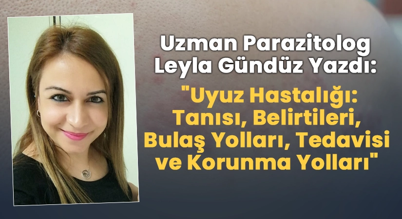 Uzman Parazitolog Leyla Gündüz Yazdı: “Uyuz Hastalığı: Tanısı, Belirtileri, Bulaş Yolları, Tedavisi Ve Korunma Yolları”