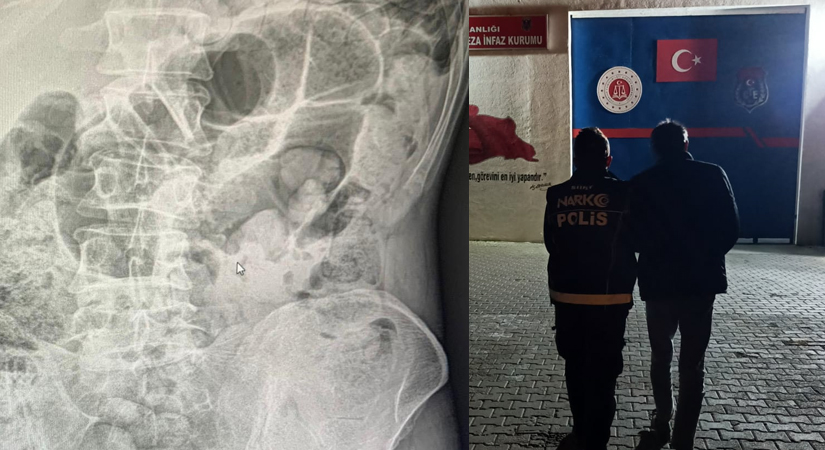 Siirt’te Midelerinde 119 Paket Uyuşturucu Bulunan 4 İran Uyruklu Tutuklandı